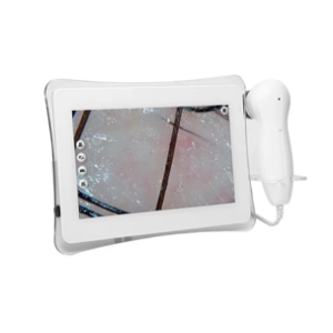 Digital Scalp Analyser Machine Hair Detector with 50 and 200x Lenses